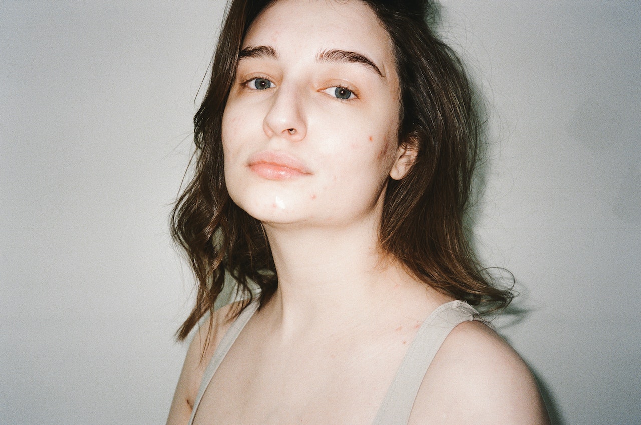 5 Tips for Wearing Makeup If You Have Acne